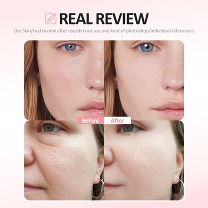 OGASABU Deep Bio Collagen Anti Wrinkle Lifting Mask 5pcs | THE ORIGINAL OVERNIGHT COLLAGEN MASK